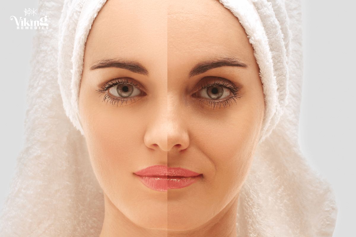 How Collagen Boosts Skin Elasticity and Fights Wrinkles (Science-Backed)